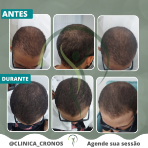 DURANTE DIOGO