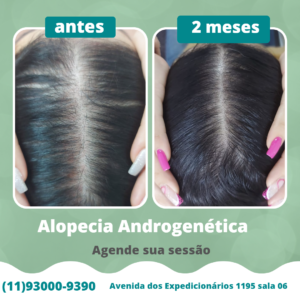 cronos androgenetica